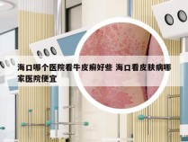 海口哪个医院看牛皮癣好些 海口看皮肤病哪家医院便宜