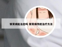 银霄病能治愈吗 银霄病传统治疗方法