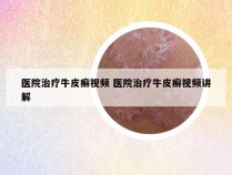 医院治疗牛皮癣视频 医院治疗牛皮癣视频讲解