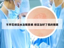 不开花绿豆水治银屑病 绿豆治好了我的银屑