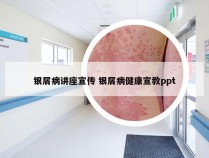 银屑病讲座宣传 银屑病健康宣教ppt