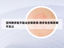 坚持跑步能不能冶愈银屑病 跑步自愈银屑病不忌口