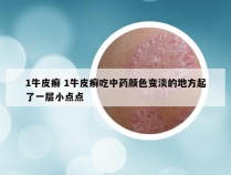 1牛皮癣 1牛皮癣吃中药颜色变淡的地方起了一层小点点