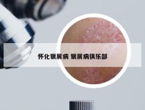 怀化银屑病 银屑病俱乐部