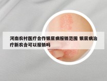 河南农村医疗合作银屑病报销范围 银屑病治疗新农合可以报销吗