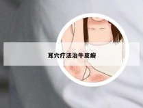 耳穴疗法治牛皮癣