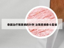 泰国治疗银屑病的针剂 冶银屑病泰斗是谁