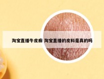淘宝直播牛皮癣 淘宝直播的皮料是真的吗