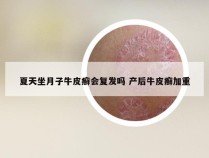 夏天坐月子牛皮癣会复发吗 产后牛皮癣加重