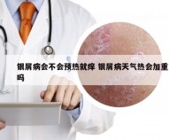 银屑病会不会预热就痒 银屑病天气热会加重吗
