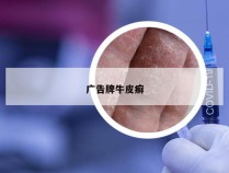 广告牌牛皮癣