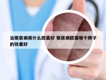 治银屑病用什么胶囊好 银屑病胶囊哪个牌子的效果好
