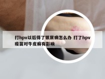 打hpv以后得了银屑病怎么办 打了hpv疫苗对牛皮癣有影响