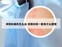 单侧白癜风怎么治 单侧白斑一般有什么规律