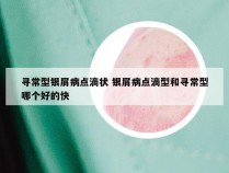 寻常型银屑病点滴状 银屑病点滴型和寻常型哪个好的快
