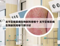 关节型银屑病生物制剂用哪个 关节型银屑病生物制剂用哪个牌子好
