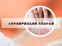 入伏牛皮癣严重怎么回事 入伏治什么病