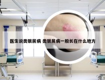 医生说类银屑病 类银屑病一般长在什么地方