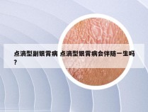 点滴型副银霄病 点滴型银霄病会伴随一生吗?