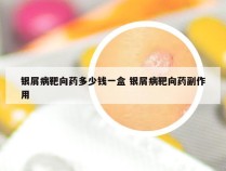 银屑病靶向药多少钱一盒 银屑病靶向药副作用