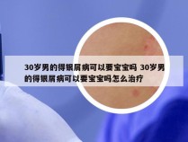 30岁男的得银屑病可以要宝宝吗 30岁男的得银屑病可以要宝宝吗怎么治疗