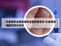 长春哪家治银屑病专业医院哪家好 长春银屑病医院预约挂号