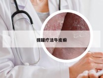 拔罐疗法牛皮癣