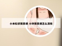 小米粒状银屑病 小块银屑病怎么清除