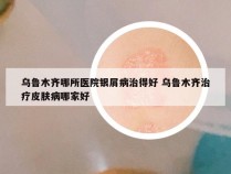 乌鲁木齐哪所医院银屑病治得好 乌鲁木齐治疗皮肤病哪家好