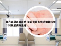 复方青黛丸银屑病 复方青黛丸和消银颗粒哪个对银屑病效果好