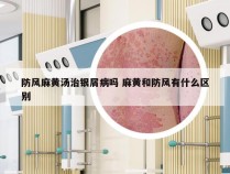 防风麻黄汤治银屑病吗 麻黄和防风有什么区别