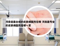 河南省最全威的皮肤病医院在哪 河南最专业的皮肤病医院是哪一家