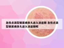 急性点滴型银屑病多久进入消退期 急性点滴型银屑病多久进入消退期呢