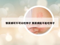 银屑病可不可以吃柿子 银屑病能不能吃柿子