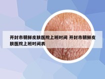 开封市朝鲜皮肤医院上班时间 开封市朝鲜皮肤医院上班时间表
