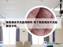 银屑病关节炎能同房吗 得了银屑病关节炎能要孩子吗