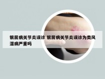 银屑病关节炎误诊 银屑病关节炎误诊为类风湿病严重吗