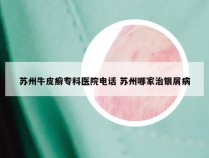 苏州牛皮癣专科医院电话 苏州哪家治银屑病