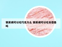 银屑病可以吃巧克力么 银屑病可以吃肯德基吗