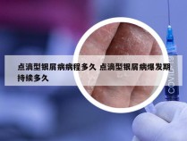 点滴型银屑病病程多久 点滴型银屑病爆发期持续多久