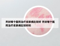 开封哪个医院治疗皮肤病比较好 开封哪个医院治疗皮肤病比较好的