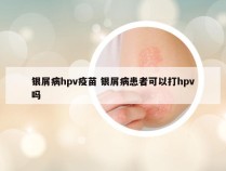 银屑病hpv疫苗 银屑病患者可以打hpv吗