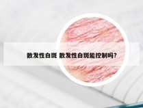散发性白斑 散发性白斑能控制吗?