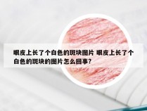 眼皮上长了个白色的斑块图片 眼皮上长了个白色的斑块的图片怎么回事?