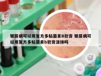 银屑病可以用复方多粘菌素B软膏 银屑病可以用复方多粘菌素b软膏涂抹吗