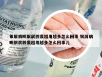 银屑病喝银屑胶囊越用越多怎么回事 银屑病喝银屑胶囊越用越多怎么回事儿