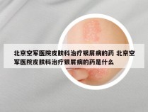 北京空军医院皮肤科治疗银屑病的药 北京空军医院皮肤科治疗银屑病的药是什么