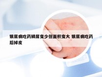 银屑病吃药鳞屑变少但面积变大 银屑病吃药后掉皮
