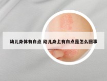 幼儿身体有白点 幼儿身上有白点是怎么回事