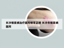 长沙银屑病治疗医院哪家正规 长沙市银屑病医院
